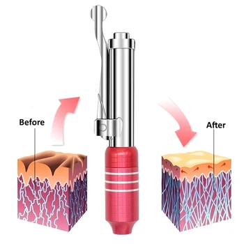 Hyaluron Pen Anvisa Enkel Mesotherapy Hyaluronsyre Lip Pen Lift Injektion Engangs Sprøjte Ansigt Rynke Fjernelse Dropshipping