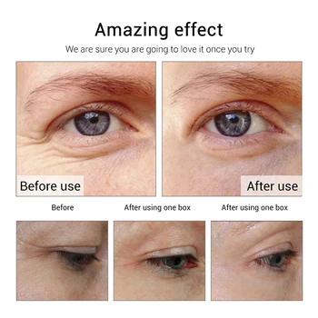 AuQuest Peptider Anti Rynke Eye Cream Fugtgivende Hud Løfte Anti-Poser Mørk Cirkel Underbag Eye Care 20G